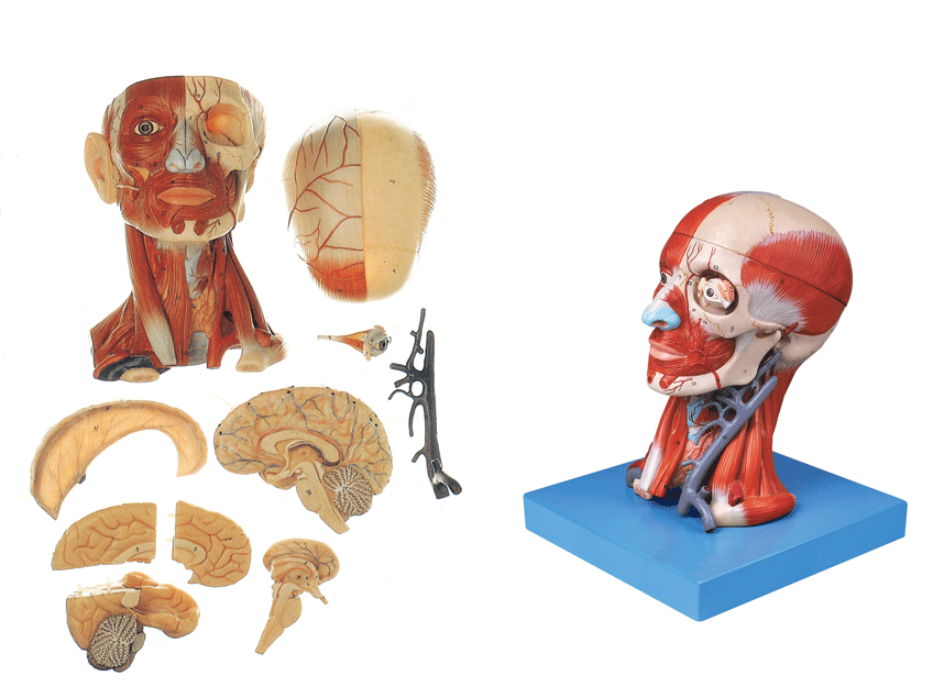 ͷ�������⡢Ѫ�ܸ���ģ��