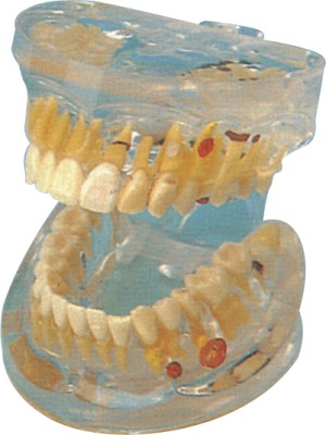 ͸�����岡��ģ��