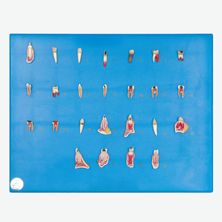 ���ݲ���ϵ��ģ��