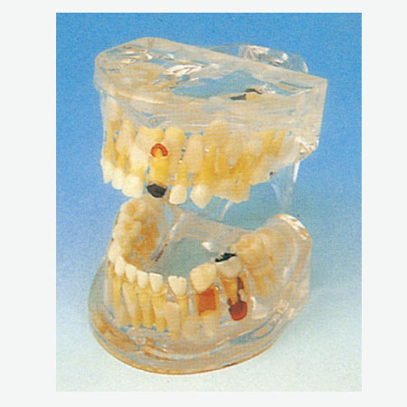 ͸�����岡��ģ��