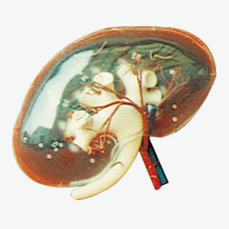 ͸������Ŵ�ģ��