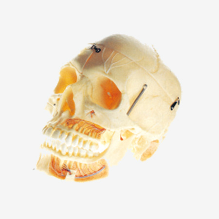 ����ͷ­�Ǹ�Ѫ����ģ��