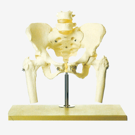 ���踽��׵��ɹ�ͷģ��