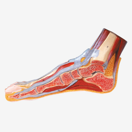 ������ʧ״����ģ��